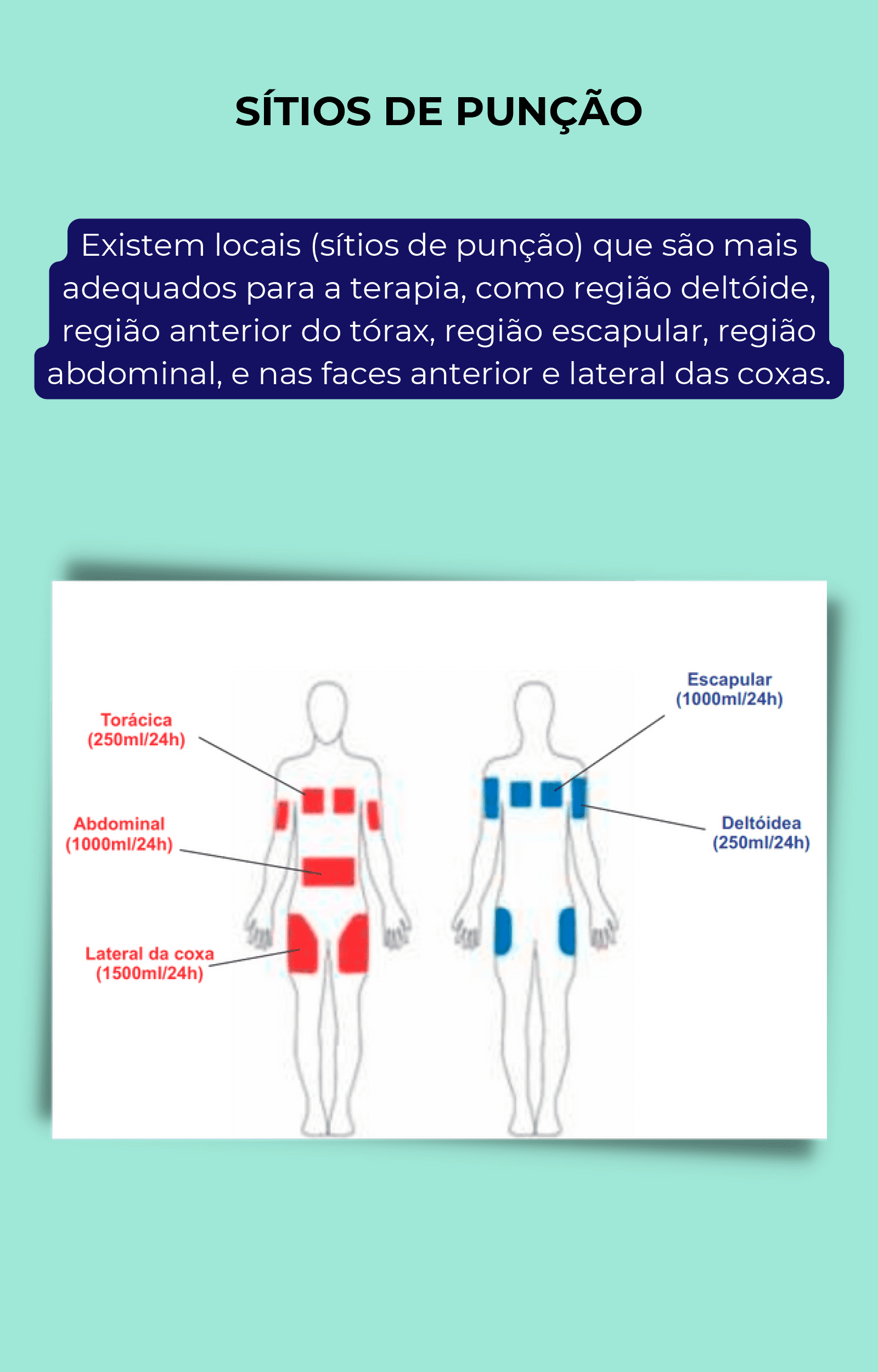 Guia Hipodermóclise na prática (1)-11